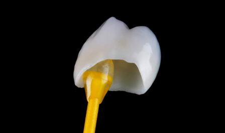 The Benefits Of Dental Crowns: Why Are They Worth The Investment?