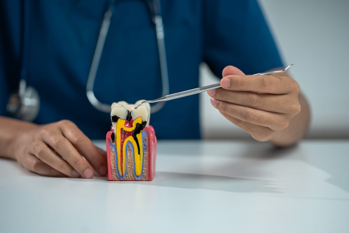 Root Canal Treatment in Cedar Grove
