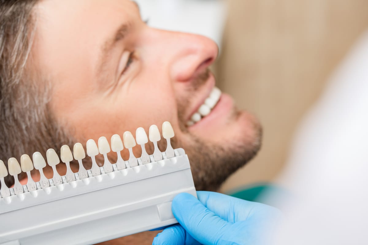 Veneers in Cedar Grove