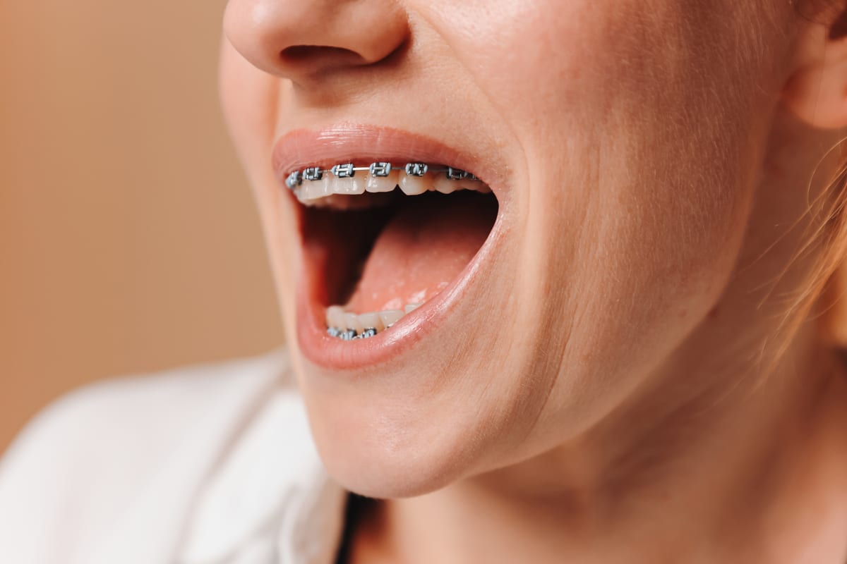 Orthodontics in Cedar Grove