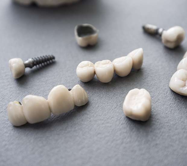Cedar Grove The Difference Between Dental Implants and Mini Dental Implants
